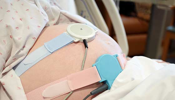 Porqué deberíamos eliminar la monitorización continua electrónica fetal de la atención sistemática